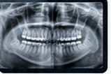 Dental X-rays